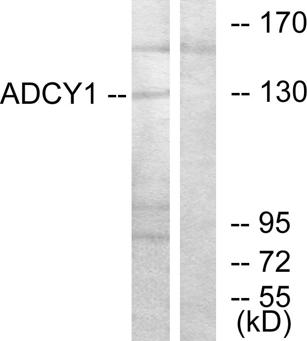  Western blot analysis of lysates from COLO205 cells, using ADCY1 Antibody. The lane on the right is blocked with the synthesized peptide.