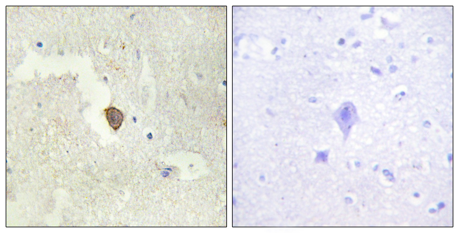  Immunohistochemistry analysis of paraffin-embedded human brain tissue, using ADCY7 Antibody. The picture on the right is blocked with the synthesized peptide.