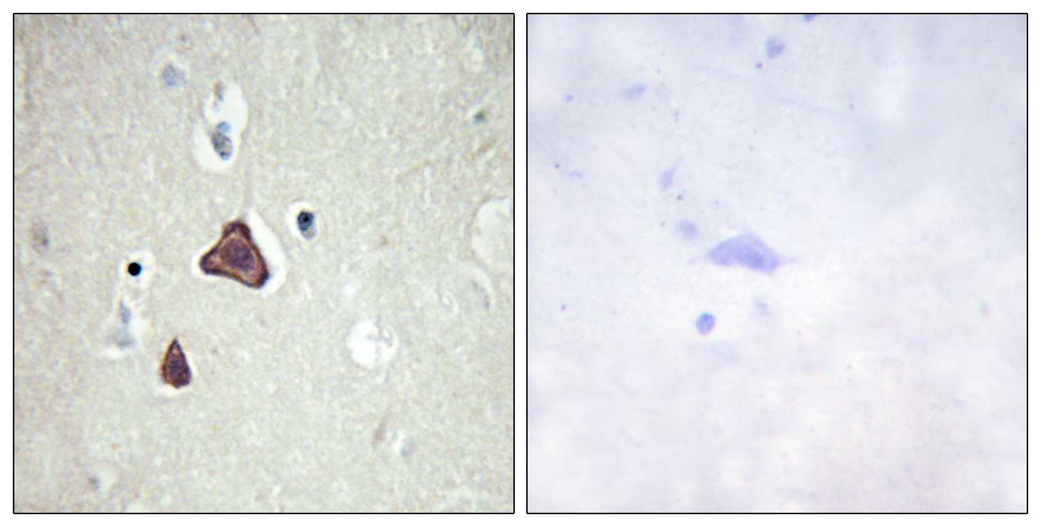  Immunohistochemistry analysis of paraffin-embedded human brain tissue, using ADCY8 Antibody. The picture on the right is blocked with the synthesized peptide.