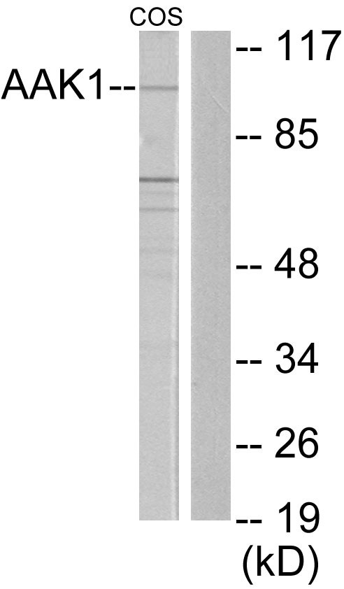  Western blot analysis of lysates from COS7 cells, using AAK1 Antibody. The lane on the right is blocked with the synthesized peptide.
