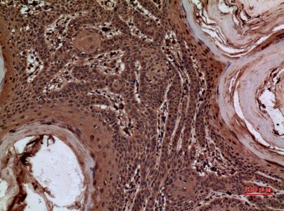  Immunohistochemical analysis of paraffin-embedded human-skin, antibody was diluted at 1:100