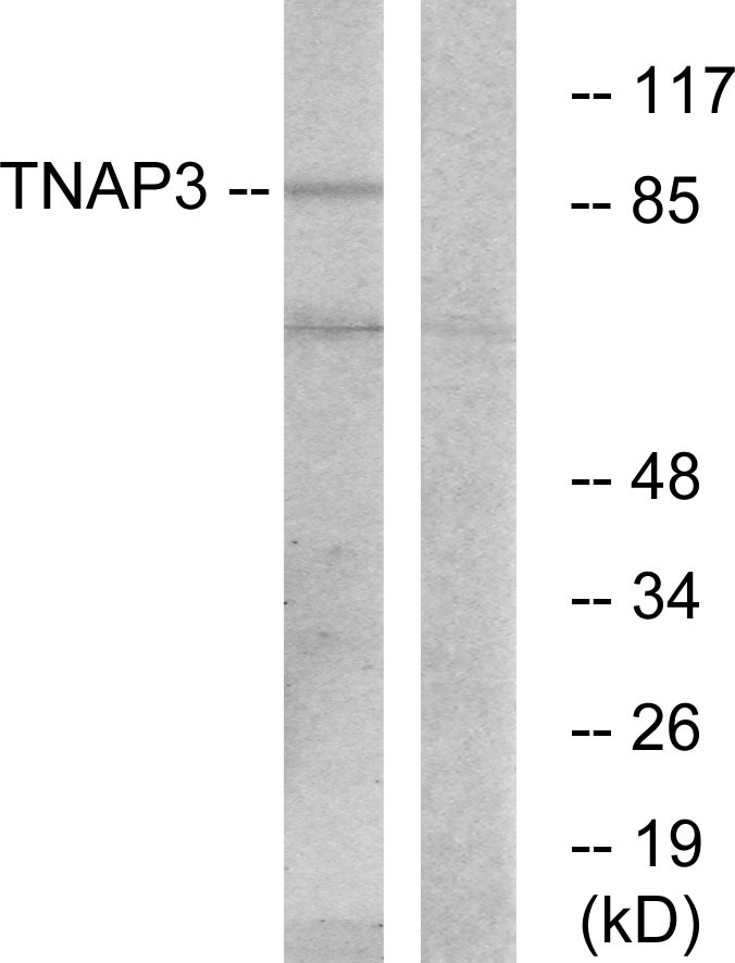  Western blot analysis of lysates from RAW264.7 cells, using TNAP3 Antibody. The lane on the right is blocked with the synthesized peptide.
