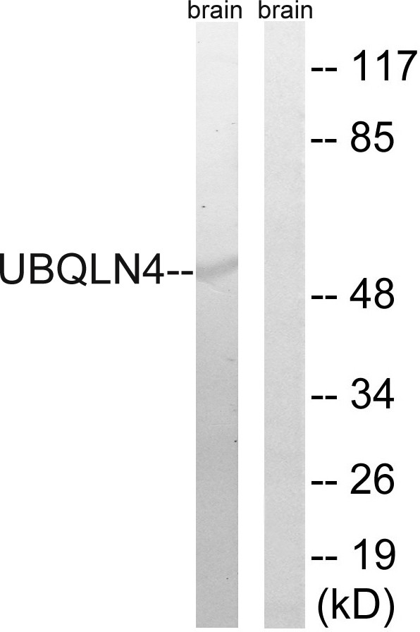  Western blot analysis of lysates from mouse brain, using UBQLN4 Antibody. The lane on the right is blocked with the synthesized peptide.
