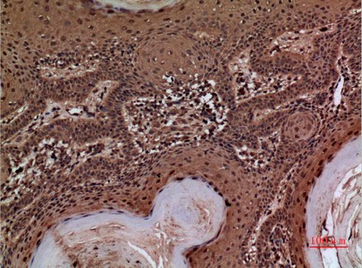  Immunohistochemical analysis of paraffin-embedded human-skin, antibody was diluted at 1:100