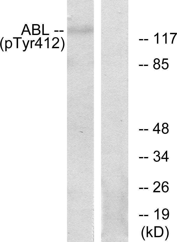  Western blot analysis of lysates from RAW264.7 cells, using Abl (Phospho-Tyr393/412) Antibody. The lane on the right is blocked with the phospho peptide.