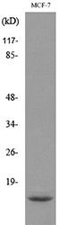  Western blot analysis of lysate from MCF7 cells, using DBI Antibody.