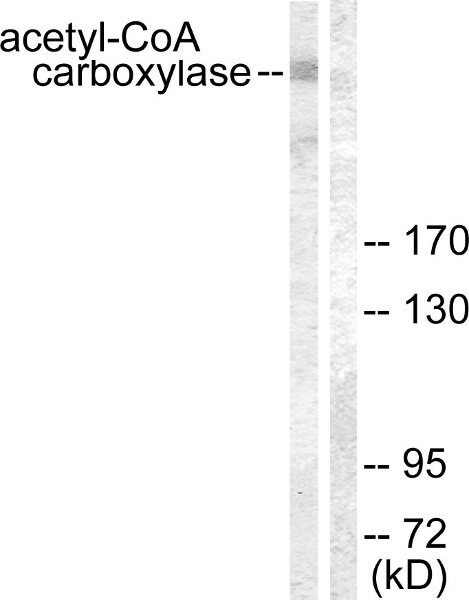  Western blot analysis of lysates from NIH/3T3 cells, treated with PMA 125ng/ml 15', using Acetyl-CoA Carboxylase Antibody. The lane on the right is blocked with the synthesized peptide.