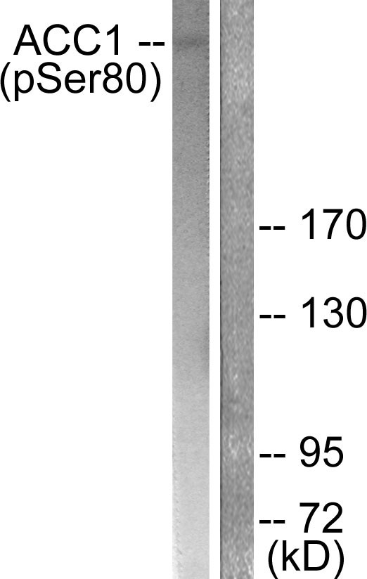 Western blot analysis of lysates from K562 cells treated with Insulin 0.01U/ml 15', using ACC1 (Phospho-Ser80) Antibody. The lane on the right is blocked with the phospho peptide.