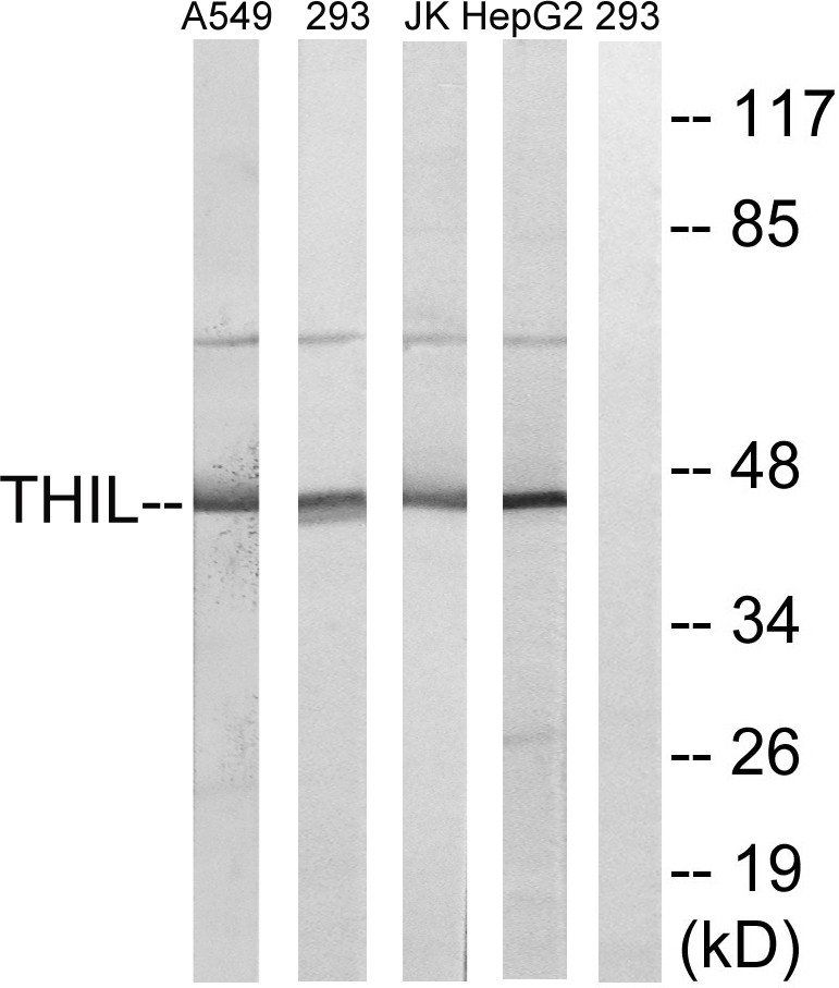  Western blot analysis of lysates from HepG2, Jurkat, 293, and A549 cells, using ACAT1 Antibody. The lane on the right is blocked with the synthesized peptide.