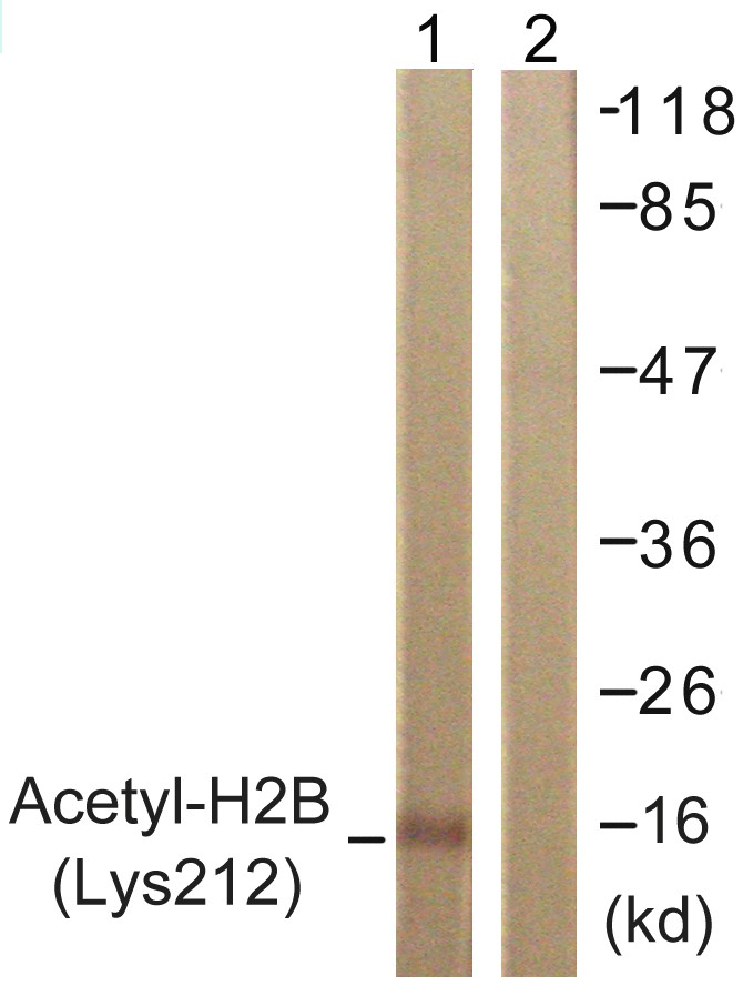  Western blot analysis of lysates from COS7 cells, treated with TSA 400nM 24h, using Histone H2B (Acetyl-Lys12) Antibody. The lane on the right is blocked with the synthesized peptide.