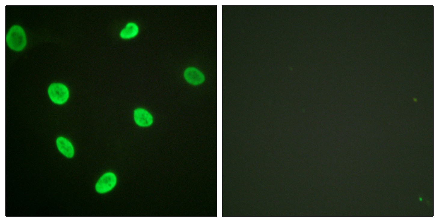  Immunofluorescence analysis of HeLa cells, using Histone H2B (Acetyl-Lys12) Antibody. The picture on the right is blocked with the synthesized peptide.