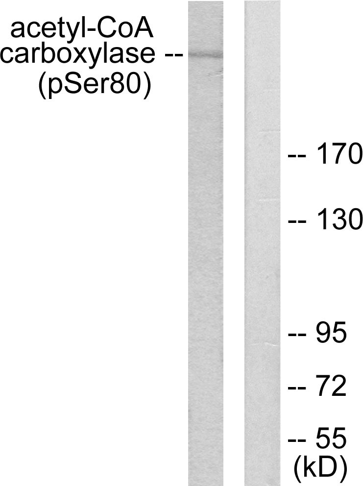  Western blot analysis of lysates from 293 cells treated with EGF 200ng/ml 5', using Acetyl-CoA Carboxylase (Phospho-Ser80) Antibody. The lane on the right is blocked with the phospho peptide.