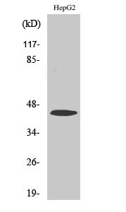  Western Blot analysis of A549 cells using ACAT-1 Polyclonal Antibody