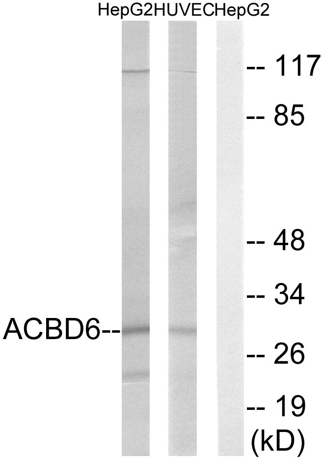  Western blot analysis of lysates from HepG2 and HUVEC cells, using ACBD6 Antibody. The lane on the right is blocked with the synthesized peptide.