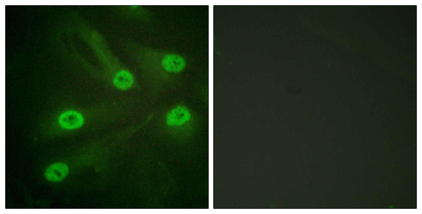  Immunofluorescence analysis of HeLa cells, using p53 (Acetyl-Lys386) Antibody. The picture on the right is blocked with the synthesized peptide.