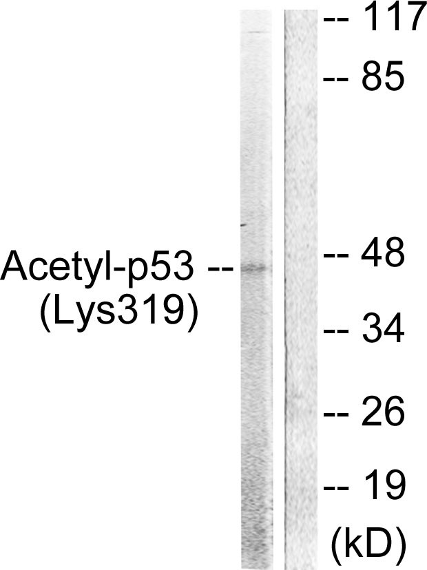  Western blot analysis of lysates from HeLa cells, treated with TSA 400nM 24h, using p53 (Acetyl-Lys317) Antibody. The lane on the right is blocked with the synthesized peptide.