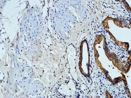  Immunohistochemical analysis of paraffin-embedded Human gallbladder. 1, Antibody was diluted at 1:100(4°,overnight). 2, High-pressure and temperature EDTA, pH8.0 was used for antigen retrieval. 3,Secondary antibody was diluted at 1:200(room temperature, 30min).