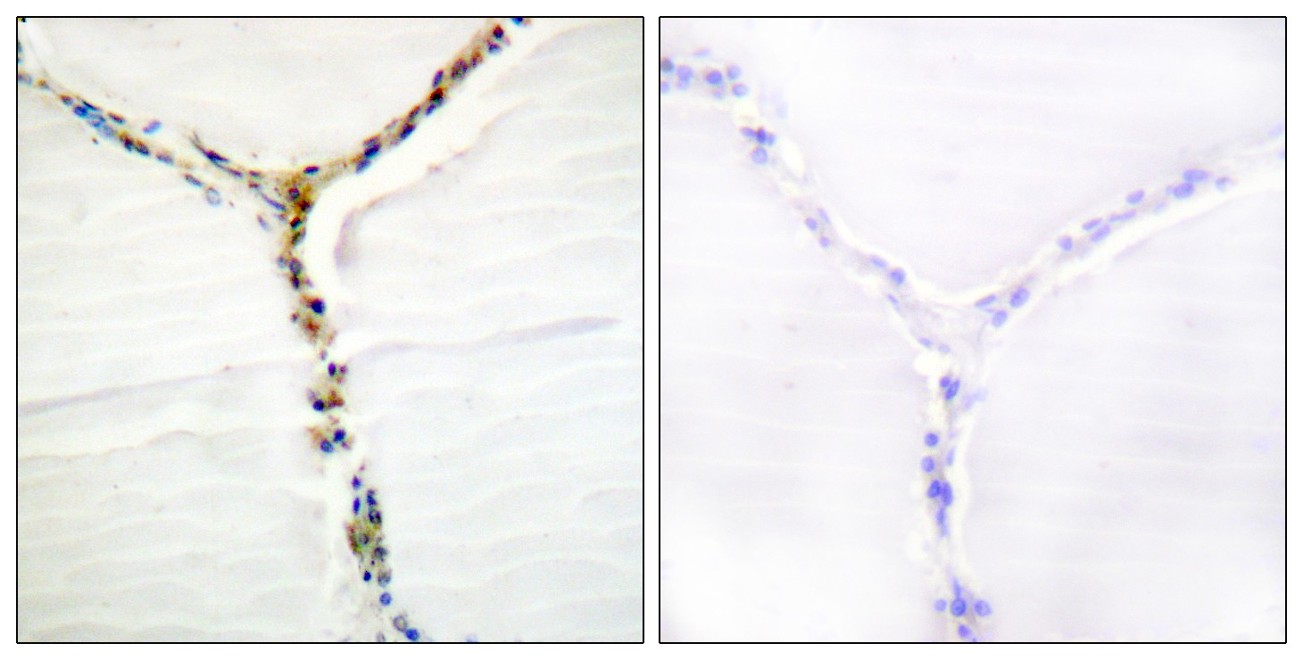  Immunohistochemistry analysis of paraffin-embedded human thyroid gland, using AhR (Phospho-Ser36) Antibody. The picture on the right is blocked with the phospho peptide.
