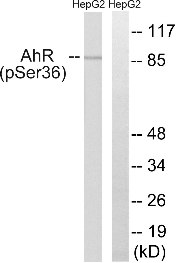  Western blot analysis of lysates from HepG2 cells, using AhR (Phospho-Ser36) Antibody. The lane on the right is blocked with the phospho peptide.