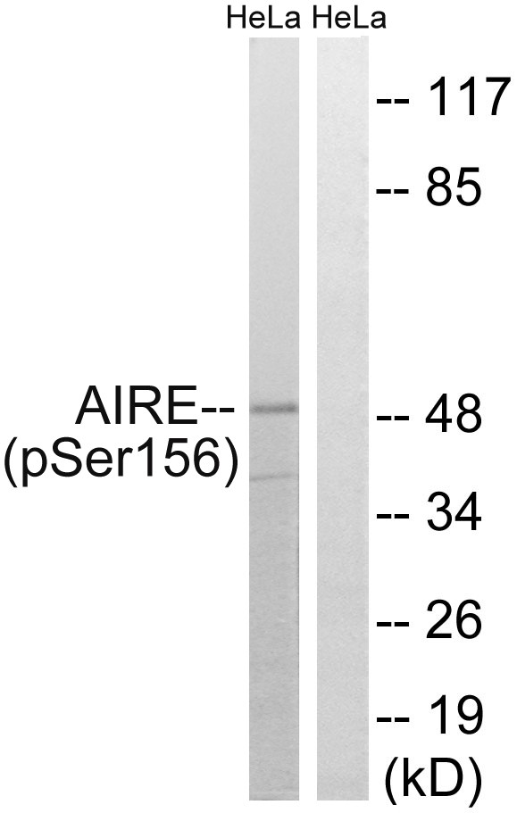 AIRE-1 (phospho Ser156) Polyclonal Antibody