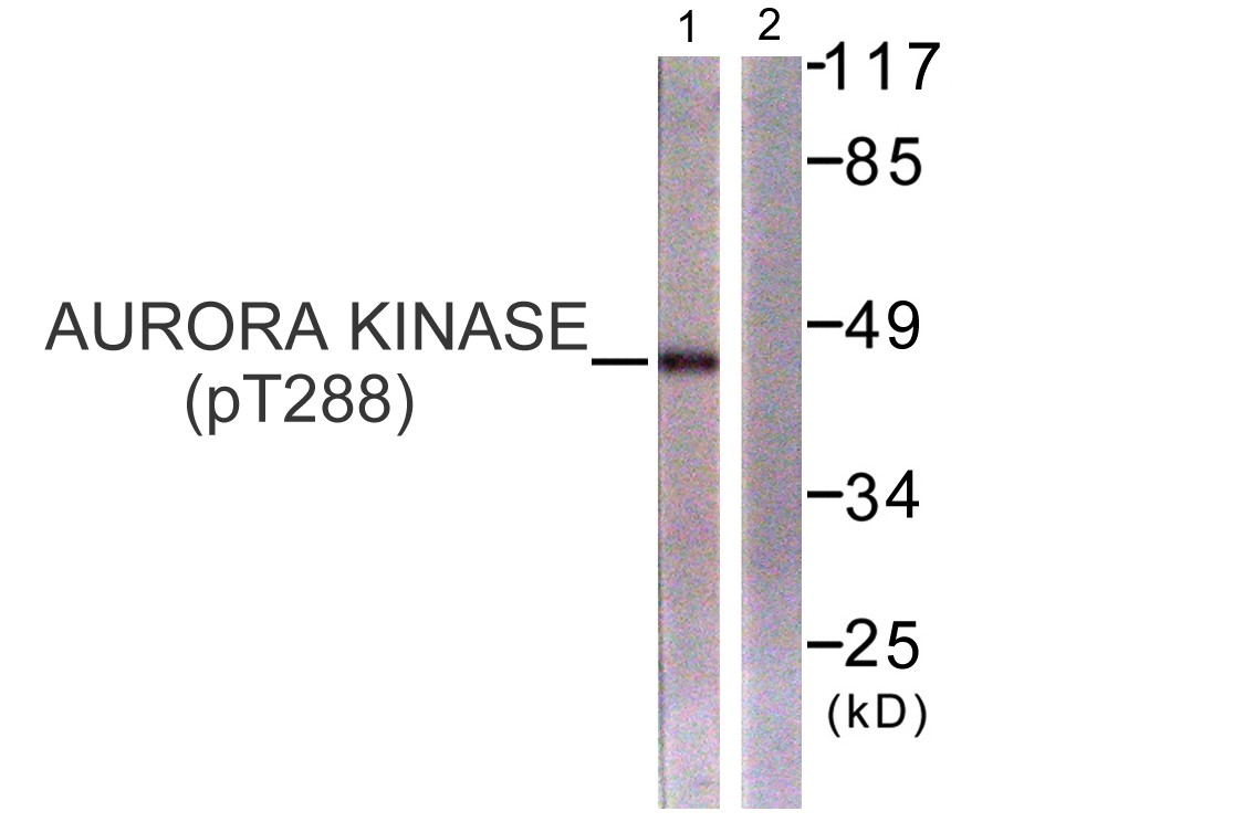 ARK-1 (phospho Thr288) Polyclonal Antibody