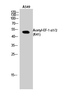 Western Blot analysis of A549 cells using Acetyl-EF-1 α1/2 (K41) Polyclonal Antibody. Secondary antibody(catalog#：RS0002) was diluted at 1:20000