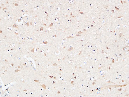  Immunohistochemical analysis of paraffin-embedded Human Brain. 1, Antibody was diluted at 1:200(4°,overnight). 2, High-pressure and temperature EDTA, pH8.0 was used for antigen retrieval. 3,Secondary antibody was diluted at 1:200(room temperature, 30min).