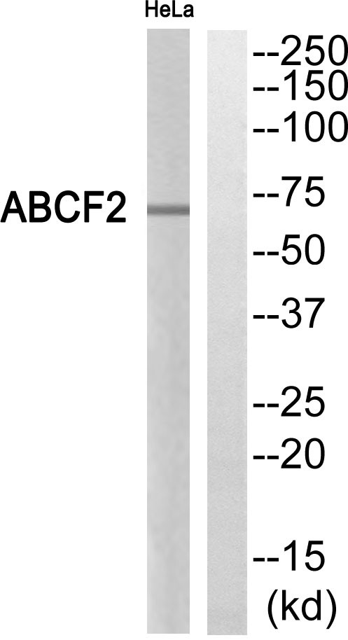  Western blot analysis of ABCF2 Antibody. The lane on the right is blocked with the ABCF2 peptide.