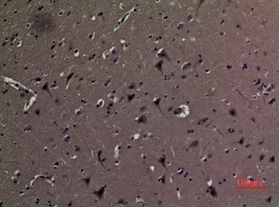  Immunohistochemical analysis of paraffin-embedded human-brain, antibody was diluted at 1:100