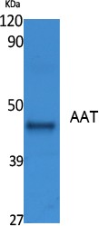 AAT Monoclonal Antibody