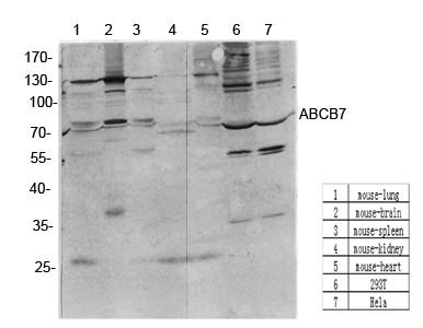  Western Blot analysis of various cells using antibody diluted at 1:1000. Secondary antibody(catalog#：RS0002) was diluted at 1:20000