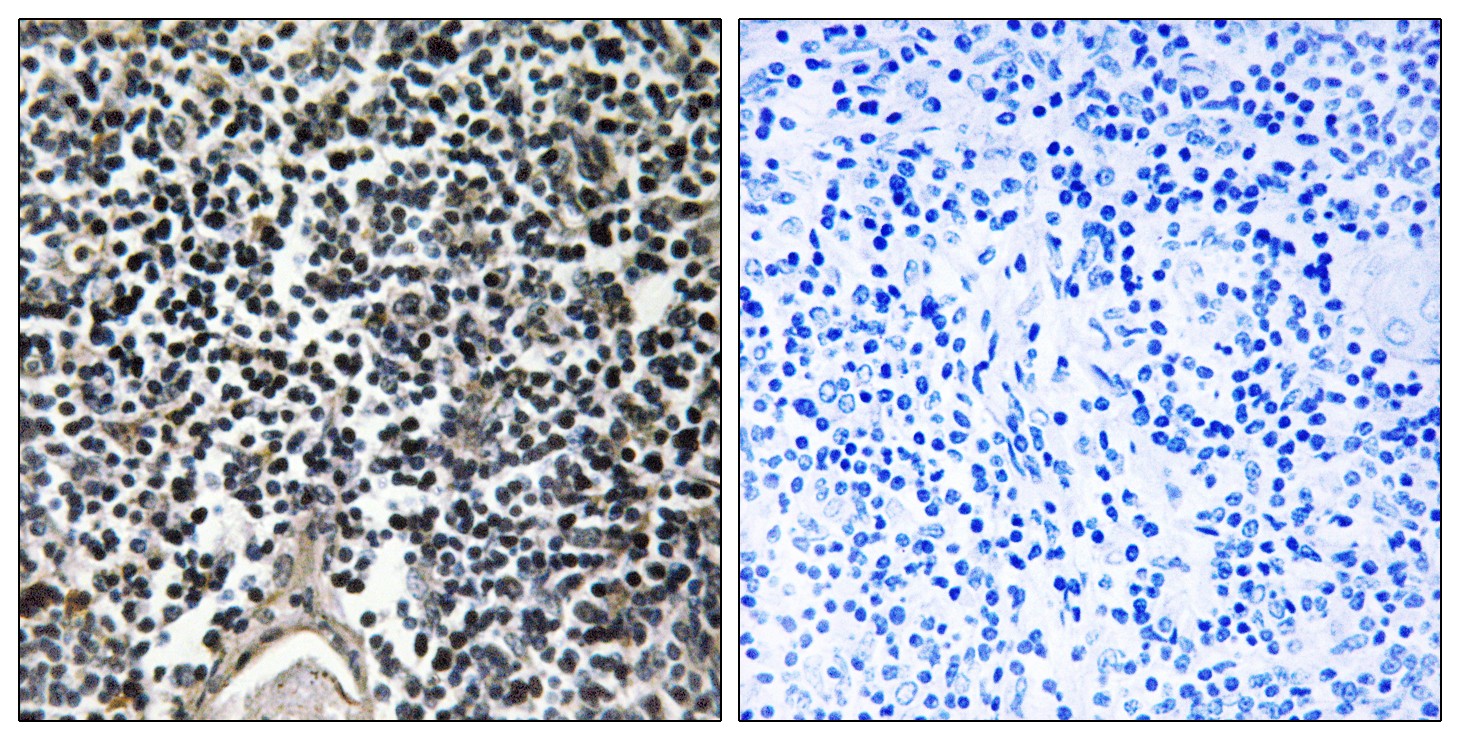  Immunohistochemistry analysis of paraffin-embedded human thymus gland, using ABCB7 Antibody. The picture on the right is blocked with the synthesized peptide.