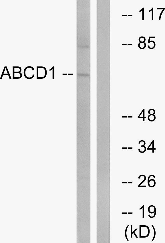  Western blot analysis of lysates from Jurkat cells, using ABCD1 Antibody. The lane on the right is blocked with the synthesized peptide.