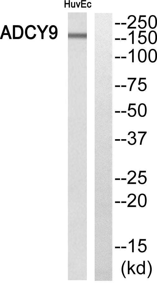  Western blot analysis of ADCY9 Antibody. The lane on the right is blocked with the ADCY9 peptide.
