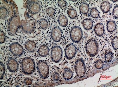  Immunohistochemical analysis of paraffin-embedded human-colon, antibody was diluted at 1:100