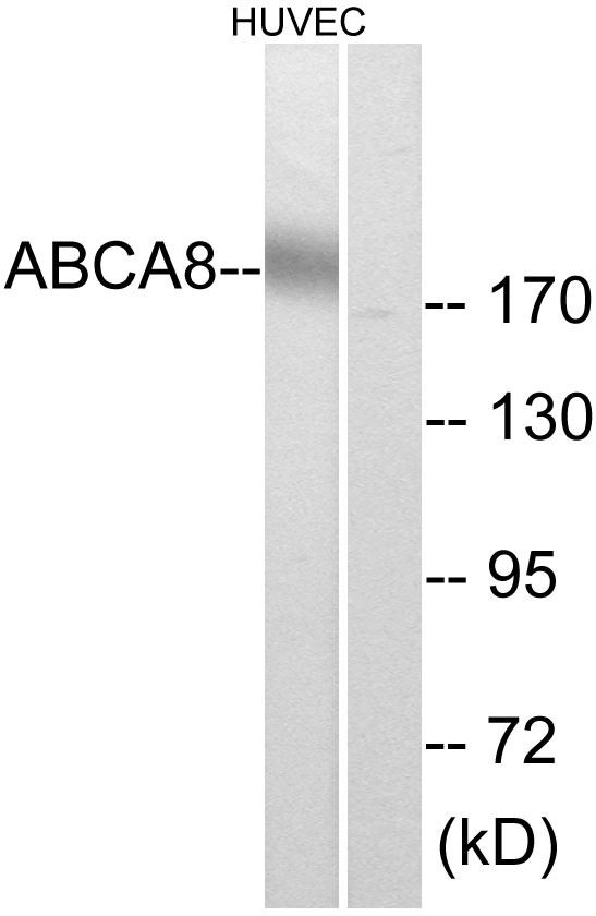  Western blot analysis of lysates from HUVEC cells, using ABCA8 Antibody. The lane on the right is blocked with the synthesized peptide.