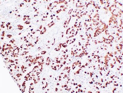  Immunohistochemical analysis of paraffin-embedded Pituitary. 1, Antibody was diluted at 1:200(4°,overnight). 2, Tris-EDTA,pH8.0 was used for antigen retrieval. 3,Secondary antibody was diluted at 1:200(room temperature, 30min).