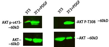  Western Blot analysis of 3T3 cells treated with PDGF using primary antibody diluted at 1:1000(4°C overnight). Secondary antibody：Goat Anti-rabbit IgG IRDye 800( diluted at 1:5000, 25°C, 1 hour)