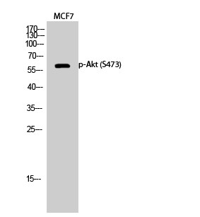  Western Blot analysis of MCF7 cells using Phospho-Akt (S473) Polyclonal Antibody diluted at 1：1000