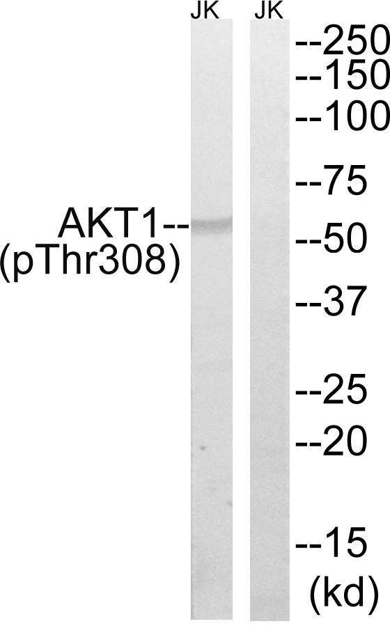  Western blot analysis of lysates from Jurkat cells treated with EGF 200ng/ml 5', using AKT1 (Phospho-Thr308) Antibody. The lane on the right is blocked with the phospho peptide.