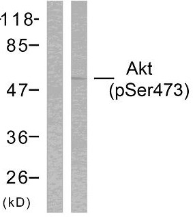  Western blot analysis of lysates from HeLa cells treated with heat shock, using Akt (Phospho-Ser473) Antibody. The lane on the left is blocked with the phospho peptide.