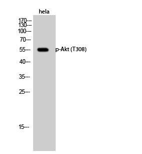  Western Blot analysis of hela cells using Phospho-Akt (T308) Polyclonal Antibody diluted at 1：1000