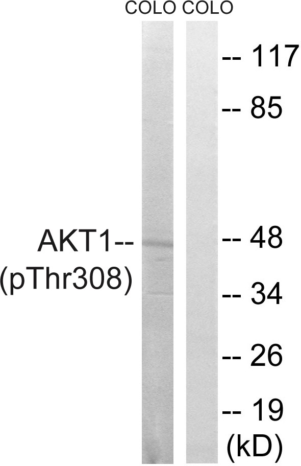  Western blot analysis of Akt (Phospho-Thr308) Antibody. The lane on the right is blocked with the Akt (Phospho-Thr308) peptide.