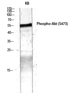  Western Blot analysis of KB using Phospho-Akt (S473) Polyclonal Antibody diluted at 1：2000