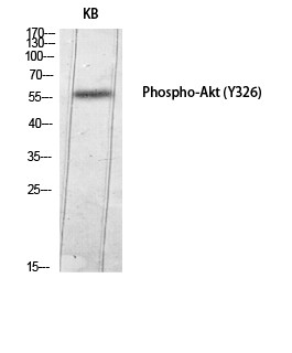  Western Blot analysis of KB using Phospho-Akt (Y326) Polyclonal Antibody diluted at 1：1000
