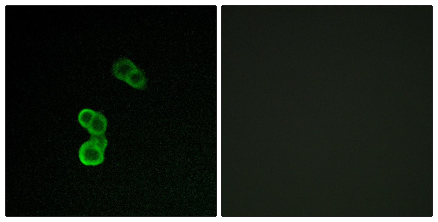  Immunofluorescence analysis of MCF-7 cells, using GAP43 (Phospho-Ser41) Antibody. The picture on the right is blocked with the phospho peptide.