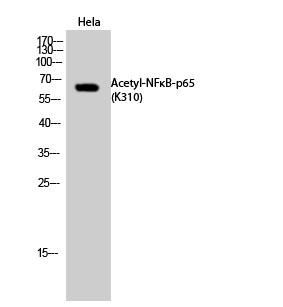  Western Blot analysis of Hela cells using Acetyl-NFκB-p65 (K310) Polyclonal Antibody diluted at 1：1000. Secondary antibody(catalog#：RS0002) was diluted at 1:20000