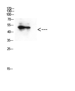  Western Blot analysis of hepg2 cells using Antibody diluted at 500. Secondary antibody(catalog#：RS0002) was diluted at 1:20000
