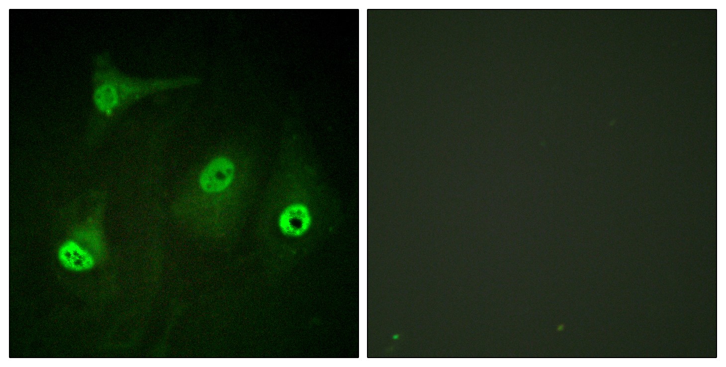  Immunofluorescence analysis of HeLa cells, using NF-kappaB p65 (Acetyl-Lys310) Antibody. The picture on the right is blocked with the synthesized peptide.