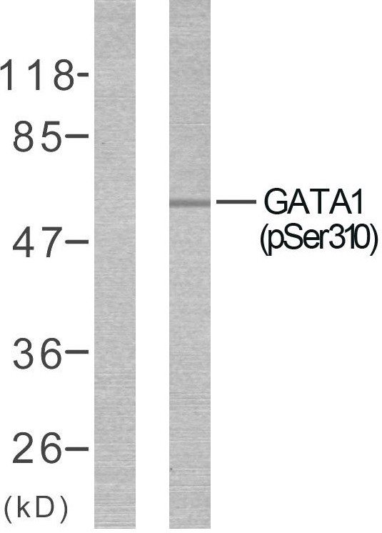 GATA-1 (phospho Ser310) Polyclonal Antibody